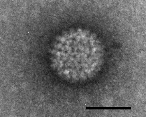 Blauzungenvirus im Elektronenmikroskop. Die Markierung entspricht 50 nm